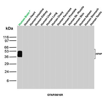 GFAP Antibody Multi-Tissue WB. Western blot analysis of human brain, heart, intestine, kidney, liver, lung, ovary, pancreas, prostate, skeletal muscle, skin, spleen, stomach, and testis tissue lysates using GFAP Antibody clone GFAP/8616R. A distinct band is detected at approximately 50 kDa selectively in human brain lysate, consistent with the predicted molecular weight of Glial fibrillary acidic protein / GFAP, an astrocyte-associated intermediate filament protein enriched within central nervous system tissue. Subtle lower molecular weight signal broadening beneath the primary band likely reflects GFAP isoforms and/or partial proteolytic processing products commonly observed in neural tissue extracts.