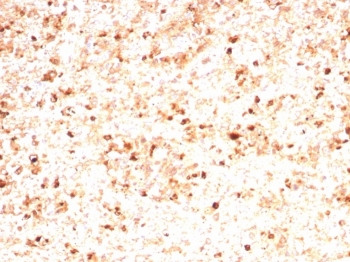 MPO Antibody Mouse Monoclonal rMPO/8694 / Myeloperoxidase Antibody. Immunohistochemistry analysis of MPO Antibody Mouse Monoclonal rMPO/8694 in FFPE human spleen tissue. Brown chromogenic staining identifies cytoplasmic Myeloperoxidase / MPO-positive myeloid cells distributed throughout the splenic tissue. Heat-induced epitope retrieval was performed by boiling tissue sections in pH 9 10mM Tris with 1mM EDTA for 20 minutes followed by cooling prior to staining.