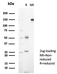 SDS-PAGE analysis of purified, BSA-free Nucleoside diphosphate kinase B antibody (clone NME2/6434) as confirmation of integrity and purity.