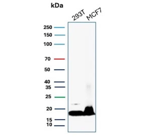 Western blot testing of human 293T and MCF7 cell lysate with Nucleoside diphosphate kinase B antibody (clone NME2/6434). Predicted molecular weight ~17 kDa.