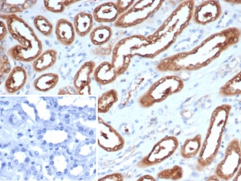 IHC staining of FFPE human kidney tissue with NDKB antibody (clone NME2/6437). Inset: PBS used in place of primary Ab (secondary Ab negative control). HIER: boil tissue sections in pH 9 10mM Tris with 1mM EDTA for 20 min and allow to cool before testing.