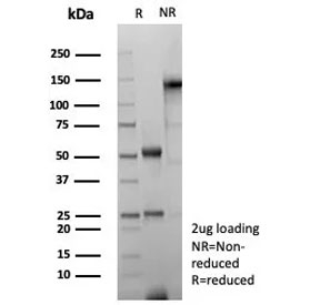 SDS-PAGE analysis of purified, BSA-free recombinant GFAP antibody (clone rGFAP/8685) as confirmation of integrity and purity.