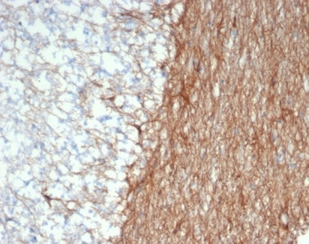 IHC staining of FFPE human brain tissue with GFAP antibody (clone GFAP/6886). HIER: boil tissue sections in pH 9 10mM Tris with 1mM EDTA for 20 min and allow to cool before testing.