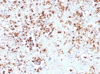 MPO Antibody Rabbit Monoclonal MPO/8631R / Myeloperoxidase Antibody. Immunohistochemistry analysis of MPO Antibody Rabbit Monoclonal MPO/8631R in FFPE human spleen tissue. Brown chromogenic staining highlights cytoplasmic Myeloperoxidase / MPO-positive myeloid cells distributed throughout the splenic tissue. Heat-induced epitope retrieval was performed by boiling tissue sections in pH 9 10mM Tris with 1mM EDTA for 20 minutes followed by cooling prior to staining.