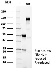 SDS-PAGE analysis of purified, BSA-free MPO Antibody Recombinant Rabbit MAb MPO/8290R as confirmation of integrity and purity.