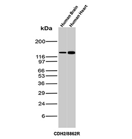 Cadherin 2 Antibody Brain and Heart WB. Western blot analysis of N-Cadherin / CDH2 expression in human brain and human heart tissue lysates using Cadherin 2 antibody clone CDH2/8862R. Lane 1: human brain lysate, Lane 2: human heart lysate. A band is detected at approximately 120-135 kDa, consistent with the predicted molecular weight of N-Cadherin (CDH2), with the slightly higher apparent migration reflecting known glycosylation of this transmembrane adhesion protein. Comparable band size and intensity between brain and heart samples support consistent detection of N-Cadherin across distinct human tissues, aligning with its conserved role in neural and cardiac cell-cell adhesion.