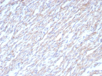 Cadherin 2 Antibody Heart Tissue IHC. Immunohistochemical analysis of N-Cadherin / CDH2 expression in formalin-fixed, paraffin-embedded human heart tissue using Cadherin 2 antibody clone CDH2/8862R. Membranous and cytoplasmic staining is observed in cardiomyocytes, with signal accentuated along cell-cell junctions consistent with localization at intercalated discs. The staining highlights elongated cardiac muscle fibers with organized architecture, while surrounding interstitial areas show minimal background. HIER: boil tissue sections in pH 9 10mM Tris with 1mM EDTA for 20 min and allow to cool before testing.