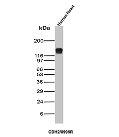 Western blot testing of human heart tissue lysate with N-Cadherin antibody (clone CDH2/8998R). Predicted molecular weight ~100 kDa (unmodified), 125-140 kDa (modified).