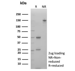 SDS-PAGE analysis of purified, BSA-free N-Cadherin antibody (clone CDH2/8998R) as confirmation of integrity and purity.