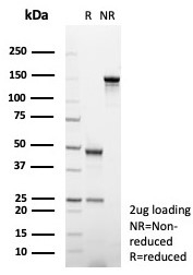 SDS-PAGE analysis of purified, BSA-free CD31 antibody (clone C31/8242R) as confirmation of integrity and purity.