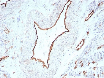 Immunohistochemistry analysis of PECAM-1 / CD31 antibody in human uterus. FFPE human uterus tissue was stained with PECAM-1 / CD31 antibody (clone C31/8831R). HRP-DAB brown chromogenic signal is observed predominantly along the endothelial lining of blood vessels within the stromal compartment, with membranous staining outlining vascular structures. Vascular endothelial cells show strong brown staining, while surrounding smooth muscle cells and stromal cells display minimal background signal. Nuclei are counterstained blue. Heat-induced epitope retrieval was performed by boiling tissue sections in 10 mM Tris with 1 mM EDTA, pH 9, for 20 minutes followed by cooling prior to antibody incubation.