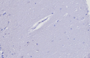 Negative control: IHC testing of FFPE human brain tissue with TIMP2 antibody (clone TIMP2/8193R) at 2ug/ml. HIER: boil tissue sections in pH 9 10mM Tris with 1mM EDTA for 20 min and allow to cool before testing.