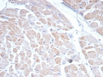 IHC staining of FFPE human heart tissue with SSTR2 antibody (clone SSTR2/7532). HIER: boil tissue sections in pH 9 10mM Tris with 1mM EDTA for 20 min and allow to cool before testing.