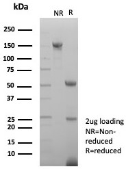 SDS-PAGE analysis of purified, BSA-free Survivin antibody (clone BIRC5/7778) as confirmation of integrity and purity.