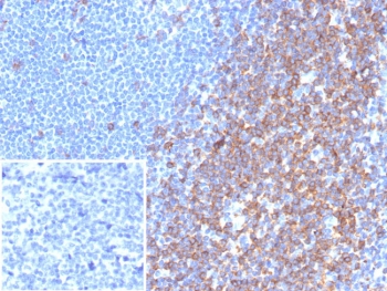 CD7 Antibody Tonsil IHC. Immunohistochemistry analysis of CD7 / T-cell antigen CD7 in human tonsil tissue shows strong HRP-DAB brown membranous staining of lymphoid cells within interfollicular regions, consistent with CD7-positive T lymphocytes and NK cell-associated populations, with minimal background in surrounding tissue. The inset demonstrates absence of staining when PBS is used in place of primary antibody, confirming specificity. CD7 antibody clone rCD7/6972 was applied following heat-induced epitope retrieval in pH 9 Tris-EDTA buffer, supporting its use as an NK cell marker in FFPE tissue sections.