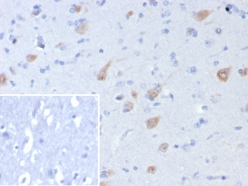IHC staining of FFPE human brain tissue with recombinant NeuN antibody (clone rNEUN/8055). Inset: PBS used in place of primary Ab (secondary Ab negative control). HIER: boil tissue sections in pH 9 10mM Tris with 1mM EDTA for 20 min and allow to cool before testing.