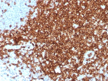 CD7 Antibody Tonsil IHC. Immunohistochemistry analysis of CD7 / T-cell antigen CD7 in human tonsil tissue demonstrates strong HRP-DAB brown membranous staining of densely packed lymphoid cells within interfollicular regions, consistent with widespread CD7 expression across T cell lineage populations, while surrounding non-lymphoid areas remain largely negative. Recombinant CD7 antibody clone CD7/8496R was applied following heat-induced epitope retrieval in pH 9 Tris-EDTA buffer, supporting its use as a T cell lineage marker in FFPE tissue sections.