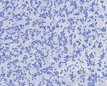 CD7 Antibody Brain Negative Control IHC. Immunohistochemistry analysis of CD7 / T-cell antigen CD7 in human brain tissue shows absence of HRP-DAB brown staining with only hematoxylin counterstain visible, consistent with lack of CD7 expression in non-lymphoid neural tissue and supporting antibody specificity. CD7 antibody clone CD7/8357R was applied at 2 ug/ml following heat-induced epitope retrieval in pH 9 Tris-EDTA buffer, serving as a negative tissue control for immune cell surface marker detection in FFPE sections.