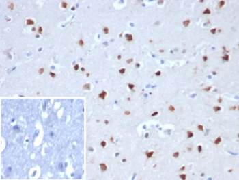 RBFOX3 Antibody Human Cerebellum Tissue Immunohistochemistry. IHC staining of FFPE human cerebellum tissue with RBFOX3antibody (clone NEUN/8096R). Inset: PBS used in place of primary Ab (secondary Ab negative control). HIER: boil tissue sections in pH 9 10mM Tris with 1mM EDTA for 20 min and allow to cool before testing.