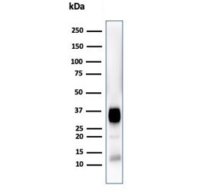 CD7 Antibody for WB. Western blot analysis of human Jurkat cell lysate using CD7 / T-cell antigen CD7 demonstrates a prominent band detected at approximately 25-40 kDa, consistent with the predicted molecular weight of CD7 and reflecting variable glycosylation states of this membrane glycoprotein. The observed band pattern aligns with known post-translational modification of CD7, where glycosylation contributes to apparent molecular weight shifts above the core protein size, supporting accurate identification of CD7 expression in T cell-derived lysates.