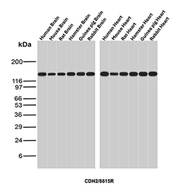 NCAD Antibody Brain and Heart Tissue WB. Western blot analysis of N-Cadherin / CDH2 (NCAD) expression across multi-species brain and heart tissue lysates using NCAD antibody clone CDH2/8815R. Lane 1: human brain lysate, Lane 2: mouse brain lysate, Lane 3: rat brain lysate, Lane 4: hamster brain lysate, Lane 5: guinea pig brain lysate, Lane 6: rabbit brain lysate, Lane 7: human heart lysate, Lane 8: mouse heart lysate, Lane 9: rat heart lysate, Lane 10: hamster heart lysate, Lane 11: guinea pig heart lysate, Lane 12: rabbit heart lysate. A band is detected at approximately 120-135 kDa, consistent with the predicted molecular weight of N-Cadherin (CDH2). The strong and consistent signal in both brain and heart tissues highlights the role of NCAD as a key adhesion protein in neural and cardiac cell-cell junctions.