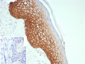 Immunohistochemistry of DSG3 antibody in human skin tissue. Formalin-fixed, paraffin-embedded human skin demonstrates strong membranous staining predominantly in basal and suprabasal keratinocytes, consistent with Desmoglein 3 localization at desmosomal cell-cell junctions within stratified squamous epithelium. Heat-induced epitope retrieval was performed by boiling tissue sections in pH 9 10mM Tris with 1mM EDTA for 20 minutes followed by cooling prior to staining. The recombinant mouse monoclonal antibody clone rDSG3/8612 was used as the primary antibody. Inset: PBS was used in place of the primary antibody as a secondary antibody negative control.