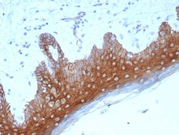 Desmoglein 1 Antibody Recombinant Rabbit MAb Human Skin IHC. Immunohistochemistry of Desmoglein 1 antibody in human skin tissue. Formalin-fixed, paraffin-embedded human skin demonstrates strong membranous staining in suprabasal keratinocytes, consistent with Desmoglein 1 localization at desmosomal cell-cell junctions within stratified squamous epithelium. Heat-induced epitope retrieval was performed by boiling tissue sections in pH 8 EDTA buffer for 20 minutes followed by cooling prior to staining. The recombinant rabbit monoclonal antibody clone DSG1/8576R was used as the primary antibody, showing distinct intercellular membrane staining throughout the epidermal layers.