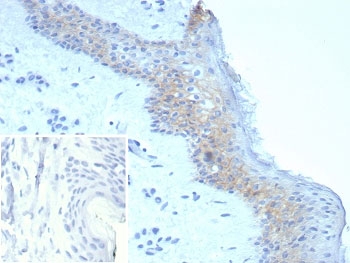 Immunohistochemistry of Desmoglein 3 antibody in human skin tissue. Formalin-fixed, paraffin-embedded human skin demonstrates membranous staining predominantly in basal and suprabasal keratinocytes, consistent with Desmoglein 3 localization at desmosomal cell-cell junctions within stratified squamous epithelium. Heat-induced epitope retrieval was performed by boiling tissue sections in pH 9 10mM Tris with 1mM EDTA for 20 minutes followed by cooling prior to staining. The rabbit monoclonal antibody clone DSG3/8251R was used as the primary antibody. Inset: PBS was used in place of the primary antibody as a secondary antibody negative control.