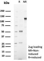 SDS-PAGE analysis of purified, BSA-free Desmoglein 3 antibody rabbit monoclonal clone DSG3/8251R as confirmation of integrity and purity.