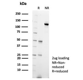 SDS-PAGE analysis of purified, BSA-free CARM1 antibody (clone CARM1/7426) as confirmation of integrity and purity.