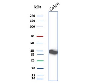 Western blot testing of human colon tissue lysate with CNN1 antibody recombinant mouse mAb. Predicted molecular weight ~34 kDa.