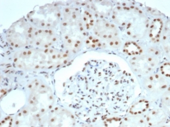 SMARCA4 Antibody Recombinant Rabbit MAb BRG1/6531R. Immunohistochemistry analysis of BRG1 / SMARCA4 in FFPE human kidney tissue demonstrates strong HRP-DAB brown nuclear staining in renal epithelial cells within the kidney tubules, consistent with the nuclear localization of the BRG1 chromatin remodeling ATPase. The staining highlights nuclei of tubular epithelial cells surrounding the glomerulus while the surrounding stromal cells show comparatively weaker nuclear signal. This nuclear staining pattern aligns with the role of SMARCA4 as a core ATP-dependent subunit of the SWI/SNF chromatin remodeling complex involved in transcriptional regulation. Heat induced epitope retrieval was performed by boiling tissue sections in pH 9 10mM Tris buffer with 1mM EDTA for 20 minutes followed by cooling prior to antibody incubation.