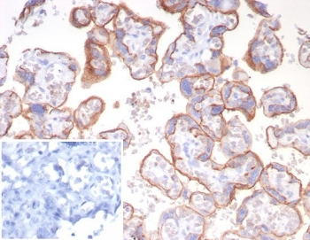 IHC staining of FFPE human placental tissue with Emmprin antibody (clone BSG/7950) at 2ug/ml. Inset: PBS used in place of primary Ab (secondary Ab negative control). HIER: boil tissue sections in pH 9 10mM Tris with 1mM EDTA for 20 min and allow to cool before testing.