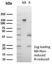 SDS-PAGE analysis of purified, BSA-free CD23 antibody (clone FCER2/8511R) as confirmation of integrity and purity.
