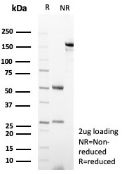 SDS-PAGE analysis of purified, BSA-free CD23 antibody (clone FCER2/8234R) as confirmation of integrity and purity.