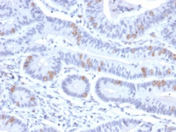 IHC staining of FFPE human colon tissue with HMG20B antibody (clone PCRP-HMG20B-1B5). HIER: boil tissue sections in pH 9 10mM Tris with 1mM EDTA for 20 min and allow to cool before testing.