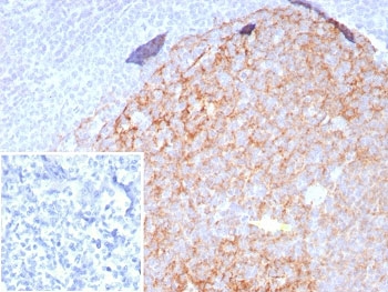IHC staining of FFPE human tonsil tissue with CD23 antibody (clone FCER2/8509R). Inset: PBS used in place of primary Ab (secondary Ab negative control). HIER: boil tissue sections in pH 9 10mM Tris with 1mM EDTA for 20 min and allow to cool before testing.