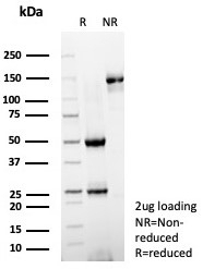 SDS-PAGE analysis of purified, BSA-free CD54 antibody (clone ICAM1/8247R) as confirmation of integrity and purity.