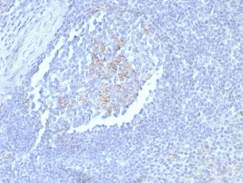 CD23 Antibody Tonsil Follicular Architecture IHC. Immunohistochemistry staining of FFPE human tonsil tissue with CD23 antibody (clone FCER2/8235R). HIER: boil tissue sections in pH 9 10mM Tris with 1mM EDTA for 20 min and allow to cool before testing.