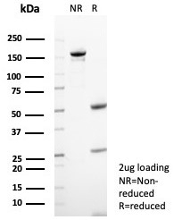 SDS-PAGE analysis of purified, BSA-free CD23 antibody (clone FCER2/8235R) as confirmation of integrity and purity.
