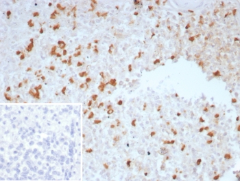 Immunohistochemistry analysis of TGFB / Transforming growth factor beta antibody in human spleen tissue (clone TGFB/7230). FFPE human spleen sections show scattered HRP-DAB brown cytoplasmic staining in immune cell populations within the splenic parenchyma, while surrounding stromal elements display minimal background signal. The distribution pattern is consistent with cytokine expression in immune regulatory cells. The inset image shows the PBS secondary-only negative control, demonstrating absence of specific staining. Heat induced epitope retrieval was performed by boiling tissue sections in pH 9 10mM Tris with 1mM EDTA for 20 minutes followed by cooling prior to antibody incubation.