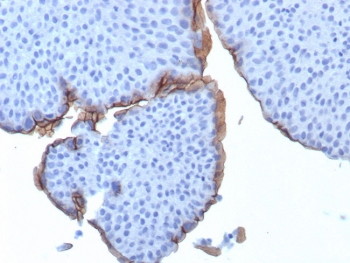 Immunohistochemistry of UPK3B antibody in human bladder tissue. The mouse monoclonal clone UPK3B/3270 shows crisp membranous HRP-DAB brown staining along the apical surface of urothelial umbrella cells lining the bladder lumen. The staining pattern highlights the luminal cell borders and specialized apical membranes, consistent with localization of Uroplakin 3B in differentiated superficial urothelial cells. Basal and intermediate cell layers display little to no specific staining, and adjacent stromal components are largely negative, providing clear contrast with the positively labeled surface epithelium. Heat-induced epitope retrieval was performed by boiling tissue sections in pH 9 10mM Tris with 1mM EDTA for 20 minutes followed by cooling prior to antibody incubation.