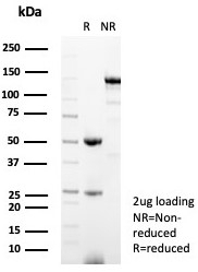 SDS-PAGE analysis of purified, BSA-free Kallikrein 5 antibody (clone KLK5/4760) as confirmation of integrity and purity.