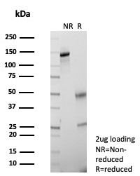 SDS-PAGE analysis of purified, BSA-free KLK5 antibody (clone KLK5/4761) as confirmation of integrity and purity.