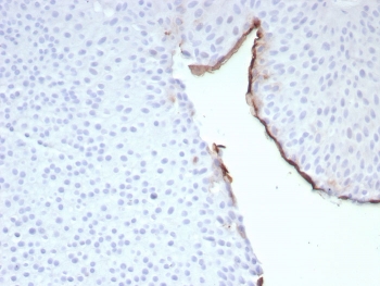 Immunohistochemistry of Uroplakin 3B antibody in human bladder tissue. The recombinant rabbit mAb clone UPK3B/8768R demonstrates distinct membranous HRP-DAB brown staining along the apical surface of urothelial umbrella cells lining the bladder lumen. The staining pattern highlights the specialized luminal membrane of differentiated superficial urothelial cells, while underlying intermediate and basal cell layers show minimal to absent signal. Stromal cells and surrounding connective tissue remain largely negative, providing clear contrast with the positively labeled epithelial surface. Heat-induced epitope retrieval was performed by boiling tissue sections in pH 9 10mM Tris with 1mM EDTA for 20 minutes followed by cooling prior to antibody incubation.