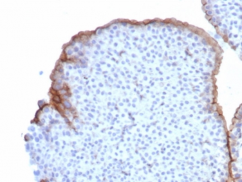 Immunohistochemistry of Uroplakin 3B antibody in human bladder tissue. Clone UPK3B/8550R demonstrates crisp membranous HRP-DAB brown staining along the apical surface of urothelial umbrella cells lining the bladder lumen. Staining highlights the specialized luminal membrane of differentiated superficial urothelial cells, with strong signal concentrated at the cell borders facing the bladder cavity. Underlying intermediate and basal urothelial layers show minimal to absent staining, and adjacent stromal components remain largely negative, providing clear contrast with the positive epithelial surface. Heat-induced epitope retrieval was performed by boiling tissue sections in pH 9 10mM Tris with 1mM EDTA for 20 minutes followed by cooling prior to antibody incubation.