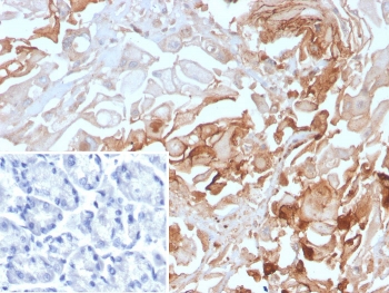 IHC staining of FFPE human stomach tissue with BGP-1 antibody (clone CEACAM1/4843). Inset: PBS used in place of primary Ab (secondary Ab negative control). HIER: boil tissue sections in pH 9 10mM Tris with 1mM EDTA for 20 min and allow to cool before testing.