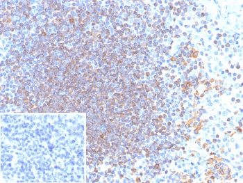 IHC staining of FFPE human tonsil tissue with CD79a antibody (clone rIGA/6986). Inset: PBS used in place of primary Ab (secondary Ab negative control). HIER: boil tissue sections in pH 9 10mM Tris with 1mM EDTA for 20 min and allow to cool before testing.
