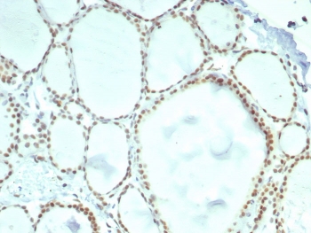 ERCC1 Antibody Thyroid IHC. Immunohistochemistry staining of FFPE human thyroid tissue with ERCC1 antibody (clone ERCC1/7596). HIER: boil tissue sections in pH 9 10mM Tris with 1mM EDTA for 20 min and allow to cool before testing.