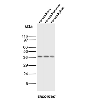 ERCC1 Antibody Tissue WB. Western blot analysis of human brain, pancreas, and spleen tissue lysates using ERCC1 Antibody (clone ERCC1/7597) detects a band at approximately 35-40 kDa, consistent with the predicted molecular weight of ERCC1, with comparable expression observed across tissues, supporting its broad distribution pattern in normal human tissues.